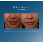 iS Clinical DAILY DINAMIC HYDRATOR